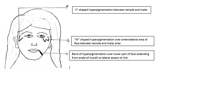Pigmentation Disorders