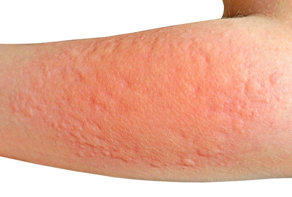 Normal Shutterstock 1710629428