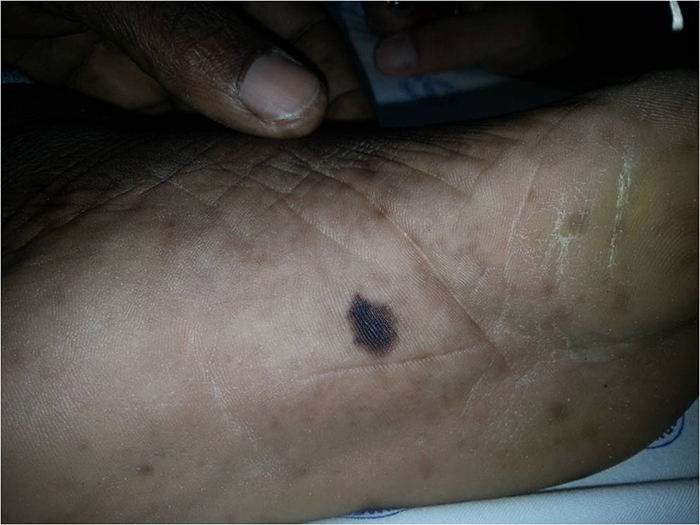 Mole Under Foot 2